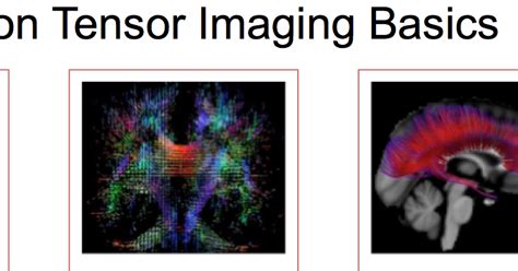 diffusion tensor imaging basics.